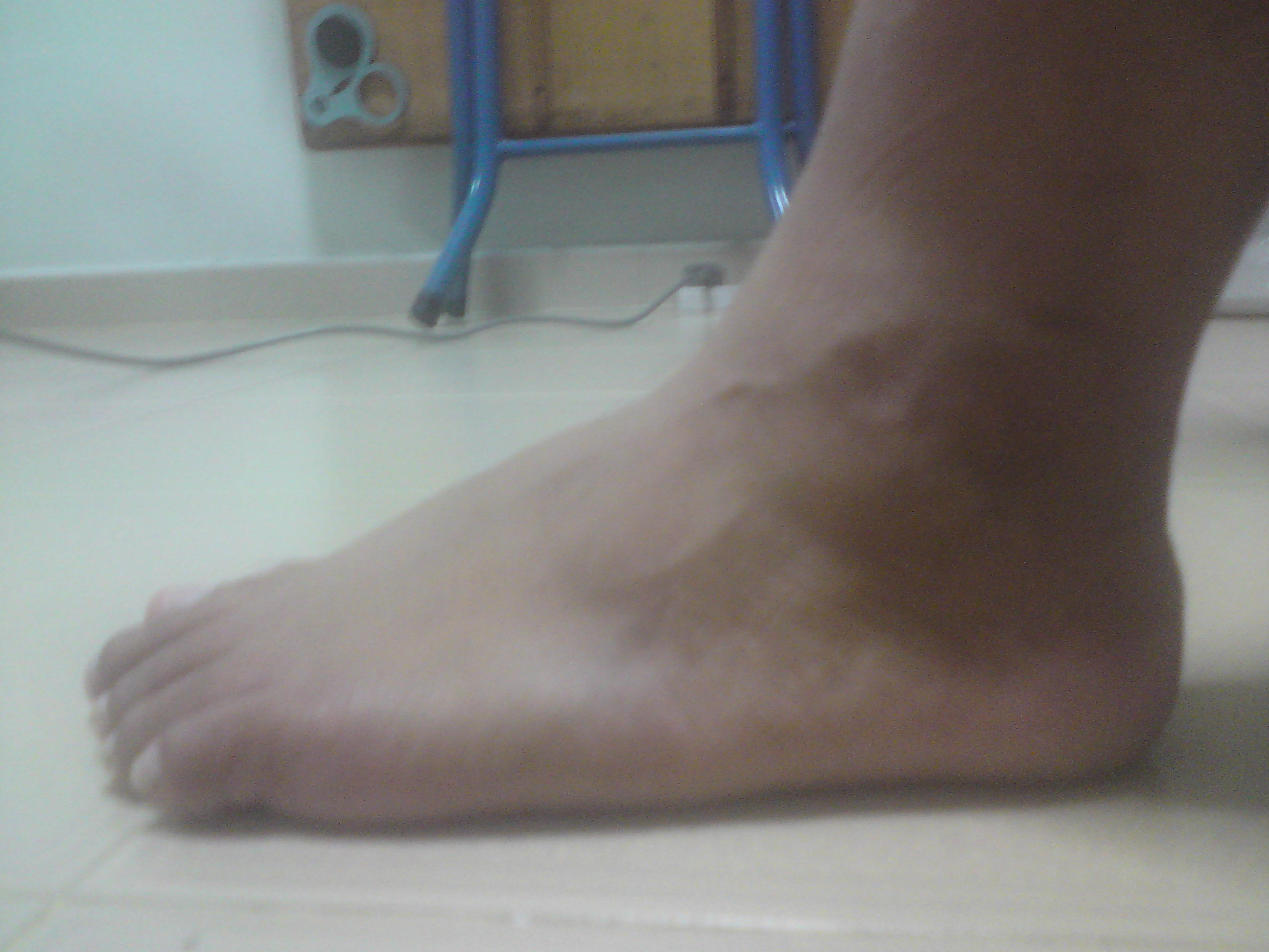 ankle