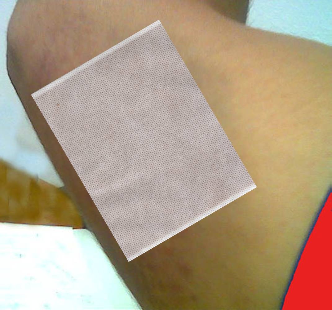 elbow with plaster