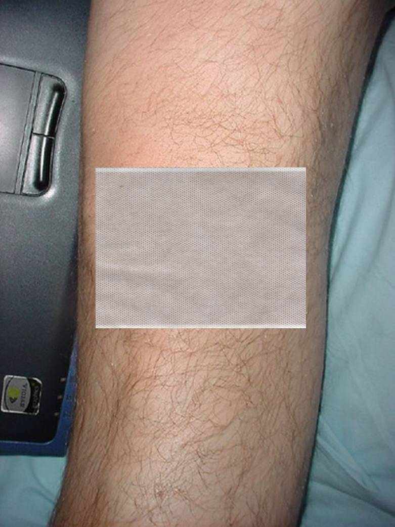 knee with plaster